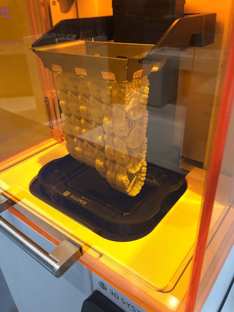 Technologie DLP impression 3D